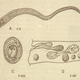 Illustration for article titled Tapeworm dies of Cancer, takes Man with it.